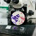 Microscope avec lames colorées de bactéries Aureus en laboratoire