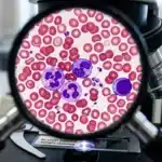 Microscope affichant globules rouges et cellules blanches colorées
